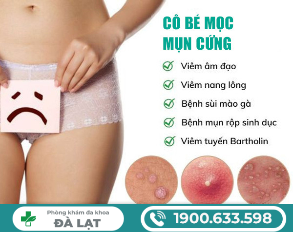 Hình ảnh minh họa